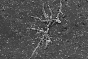 Electron microscope image of a micro-organism growing on vinyl